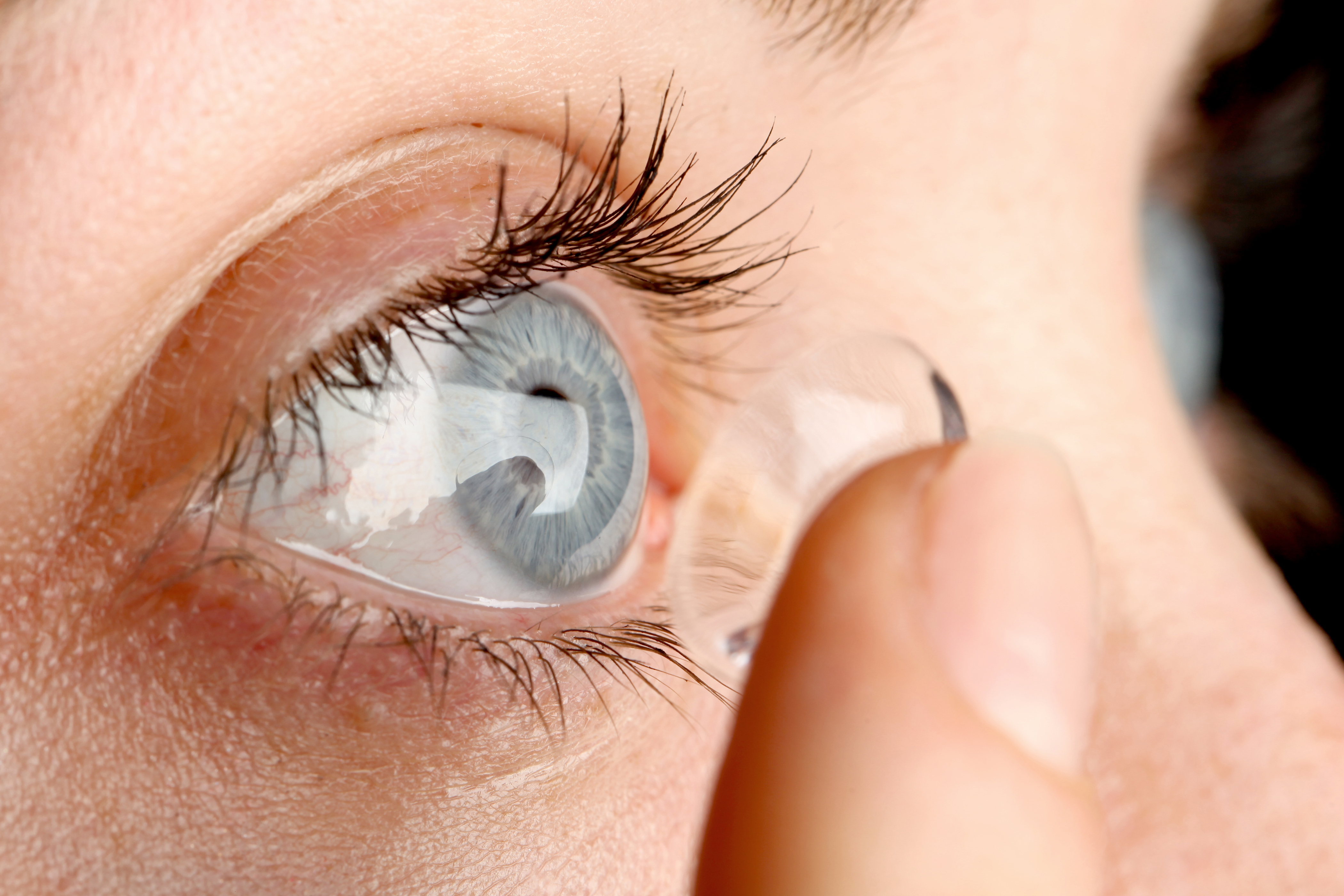 Линзы для глаз коррекция зрения. Ночные ортокератологические линзы. Ортокератология ночные линзы. Жесткие газопроницаемые контактные линзы. Исправление зрения линзами.
